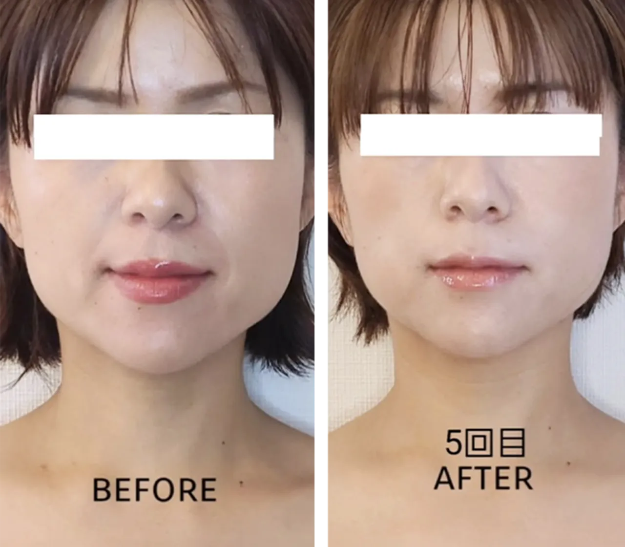 BEFORE AFTER