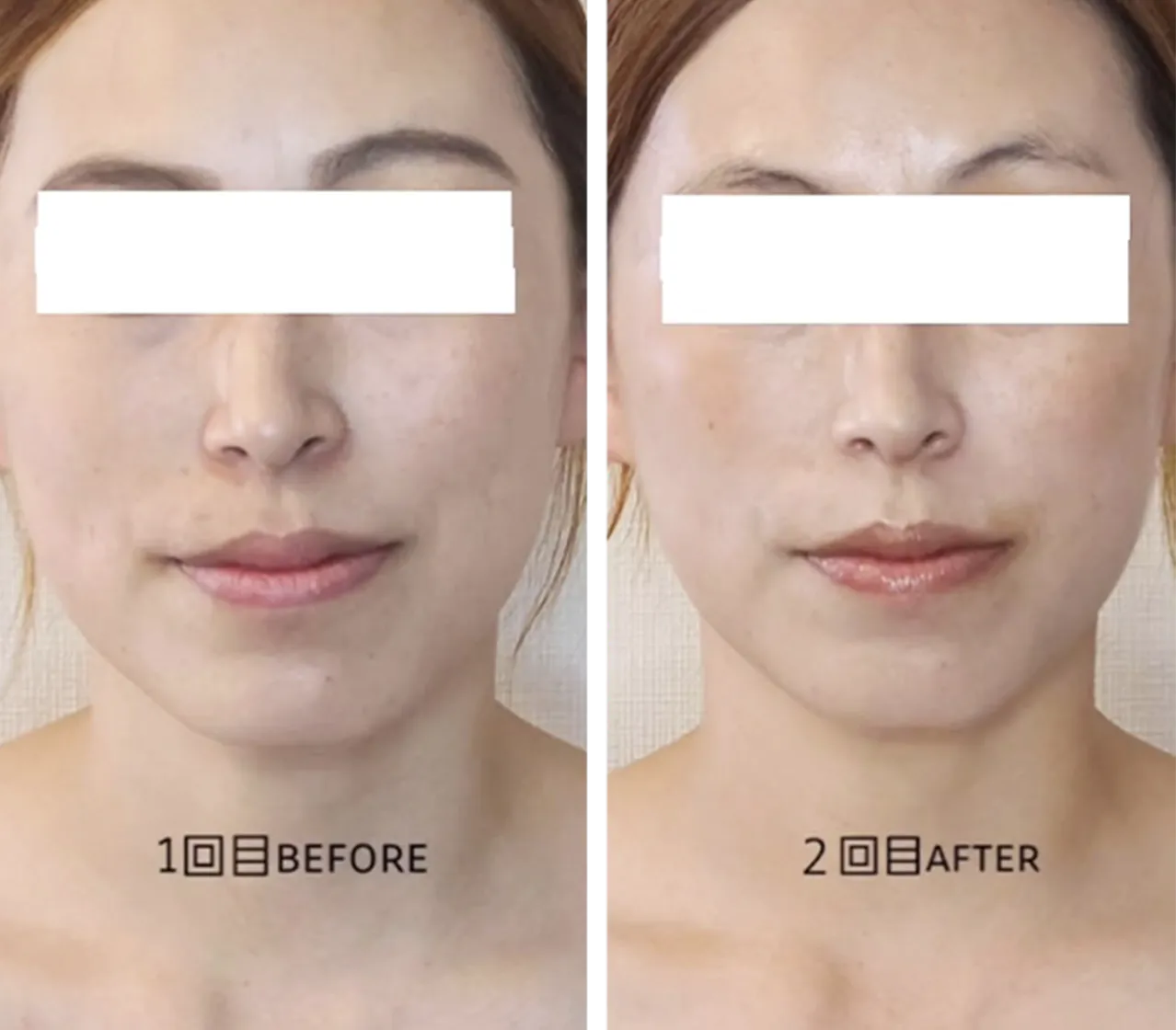 BEFORE AFTER