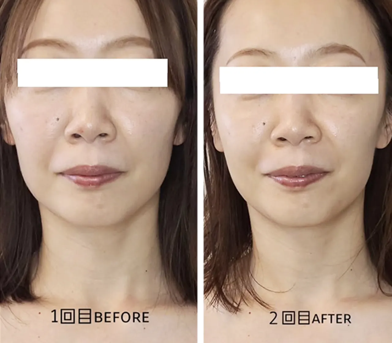BEFORE AFTER