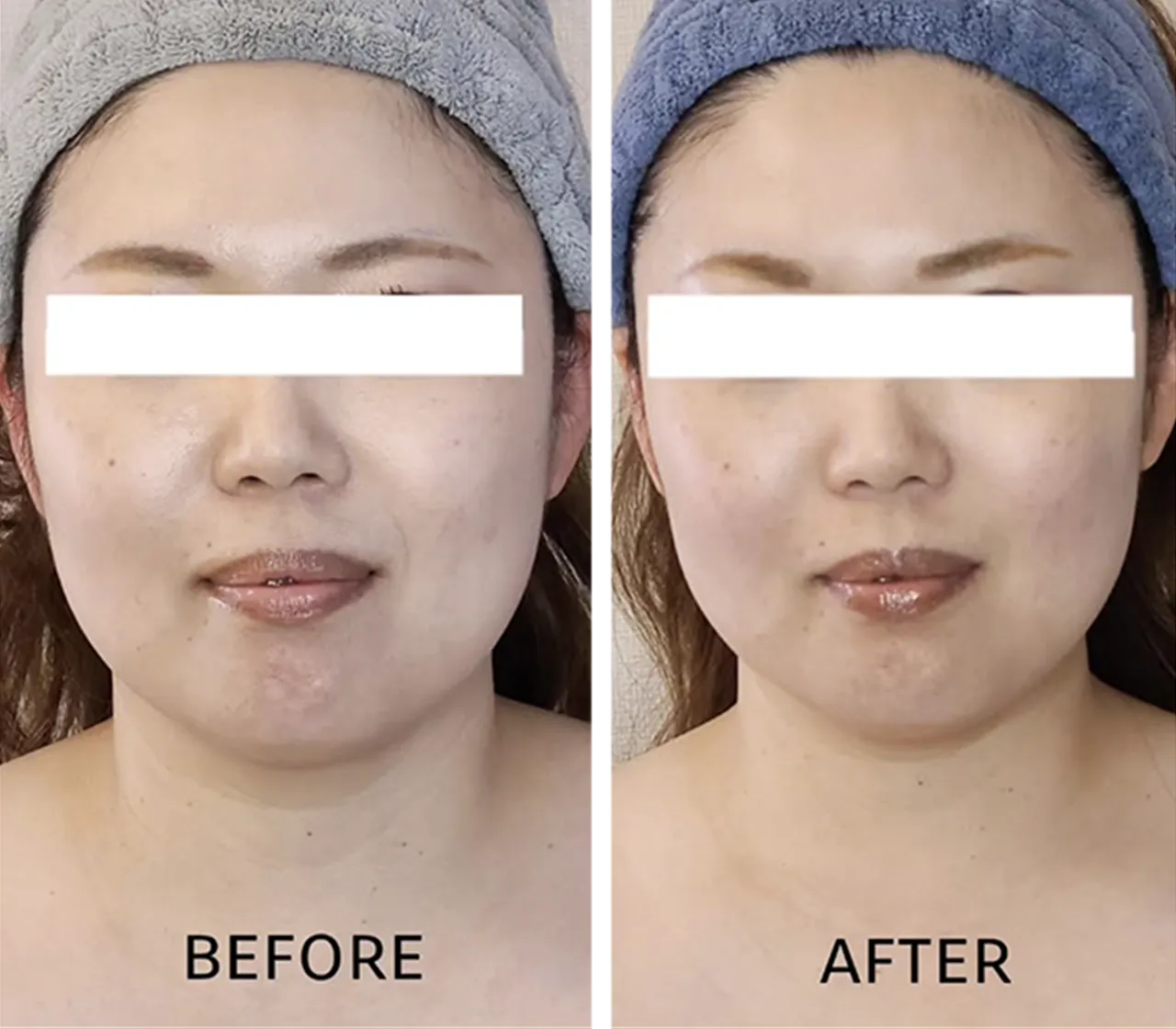 BEFORE AFTER