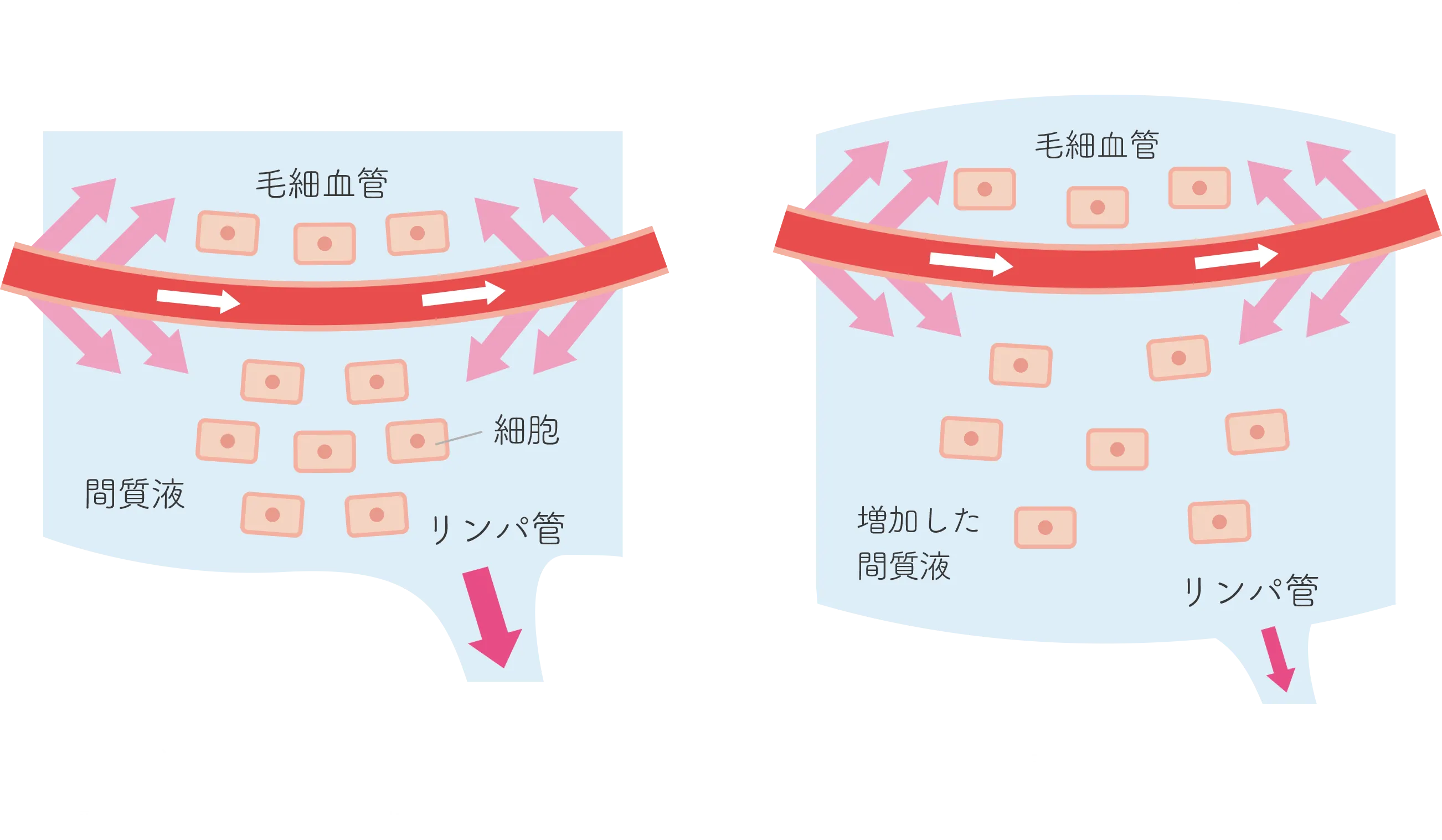 リンパの図